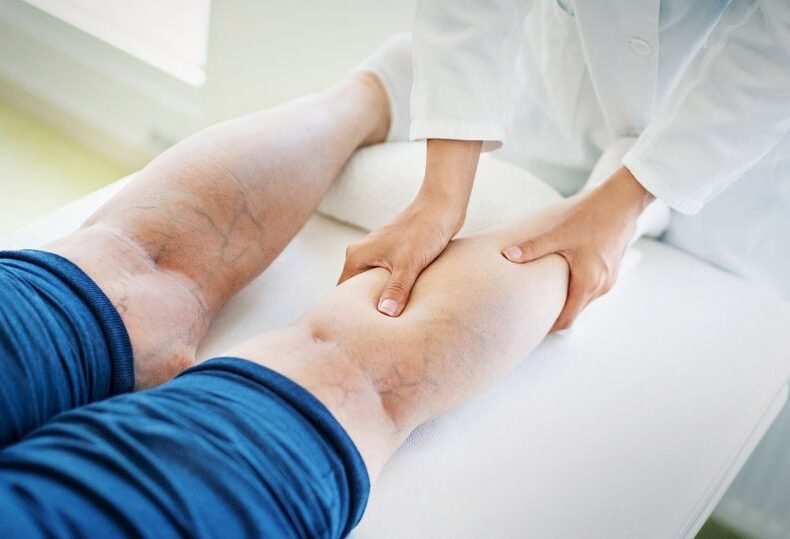 How To Find The Treatment Of Chronic Venous Insufficiency